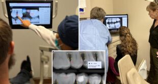 AI helps dentists catch more cavities, gum disease